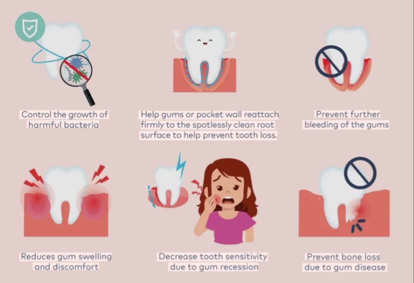 Six illustrated benefits of treating and preventing gum disease
