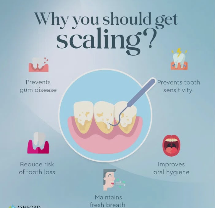 Infographic listing the five core benefits of professional dental scaling